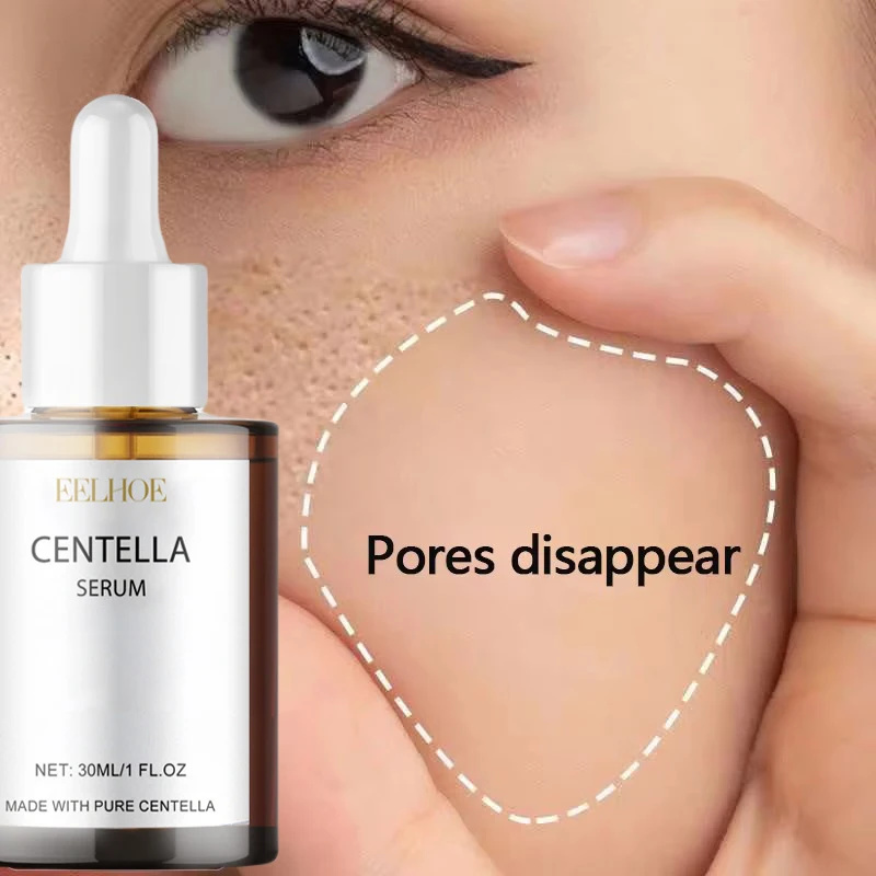 Centella Asiatica Toner - كينتيللا اسياتيكا مصل الوجه تغذي البشرة