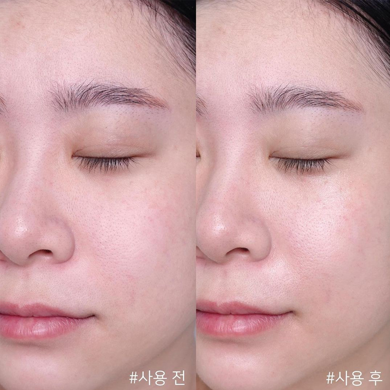 كريم سنتيلا أسياتيكا تايم ريفي - مراجعة Centella Asiatica Toner وسعره