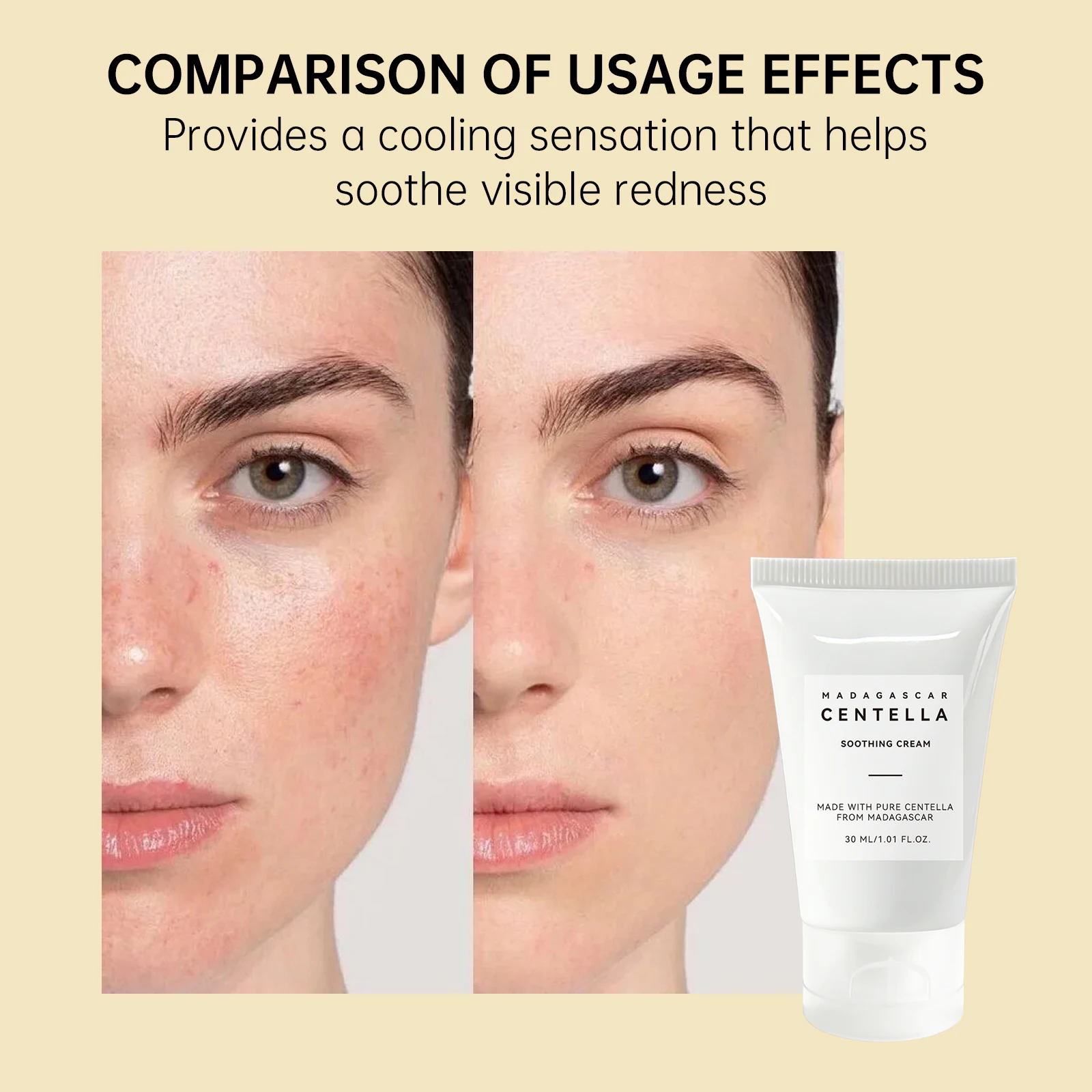 جل سنتيلا أسياتيكا المهدئ 30 م - مراجعة Centella Asiatica Toner وسعره