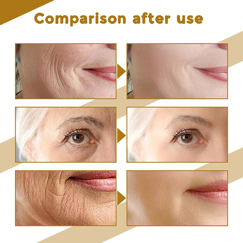 كينتيللا اسياتيكا مصل الوجه تغ - مراجعة Centella Asiatica Toner وسعره