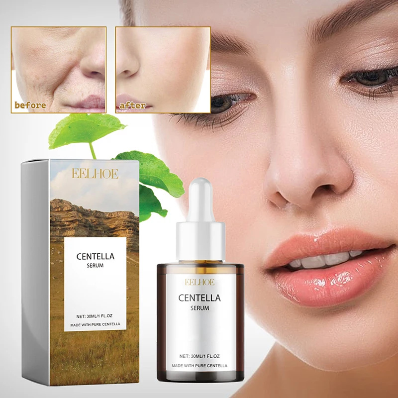 كينتيللا اسياتيكا مصل الوجه تغ - مراجعة Centella Asiatica Toner وسعره