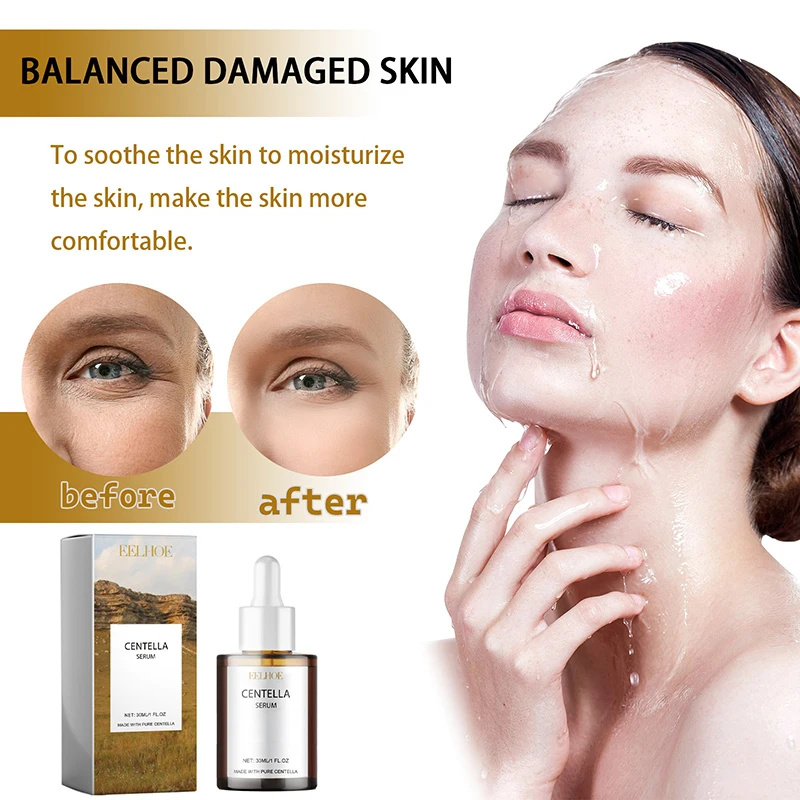 كينتيللا اسياتيكا مصل الوجه تغ - مراجعة Centella Asiatica Toner وسعره
