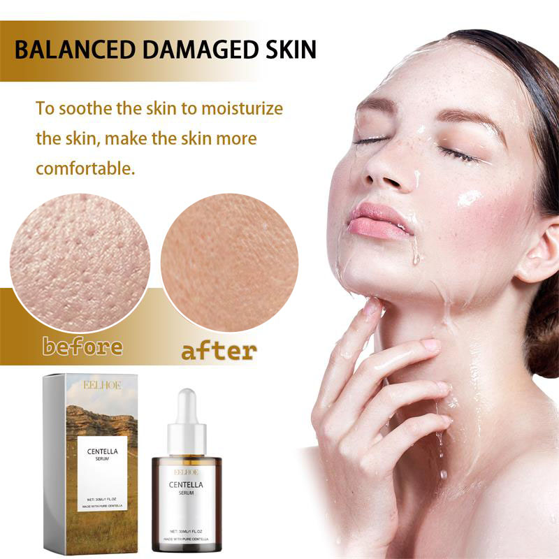 سيروم للوجه من سنتيلا أسياتيكا - مراجعة Centella Asiatica Toner وسعره